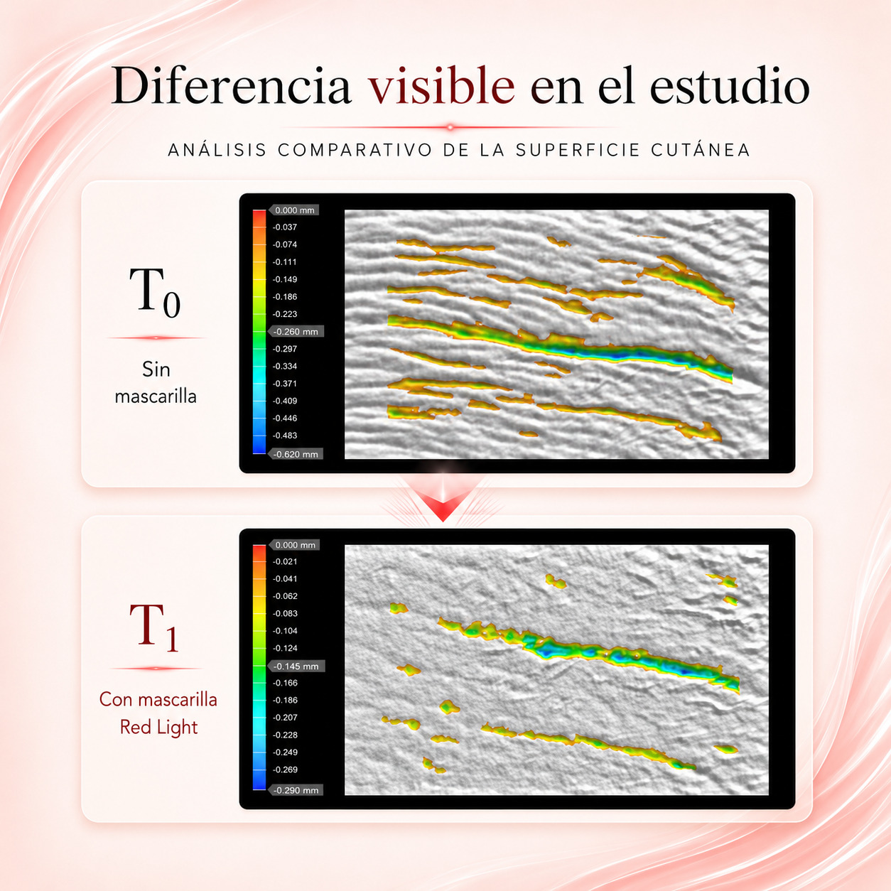 Topografía 3D de la piel: T0 antes y T1 tras 4 semanas con la mascarilla y luz roja